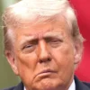 Donald Trump Latest News: चेहरे के लुक पर उठा नया विवाद